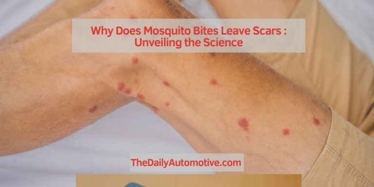 Why Does Mosquito Bites Leave Scars : Unveiling the Science