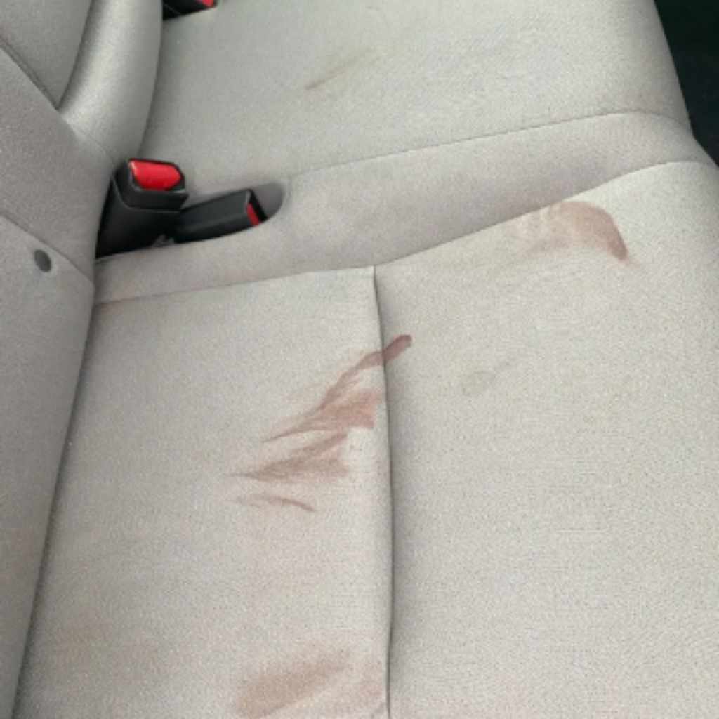 How To Remove Period Blood Stains From Car Seats